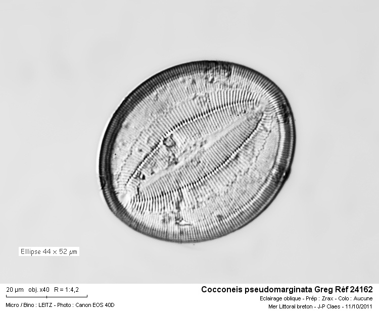 Cocconeis pseudomarginata Gregory #24349