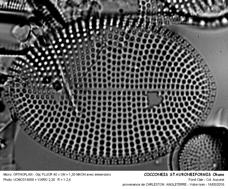 COCCONEIS STAURONEIOFORMID Okuno #45158