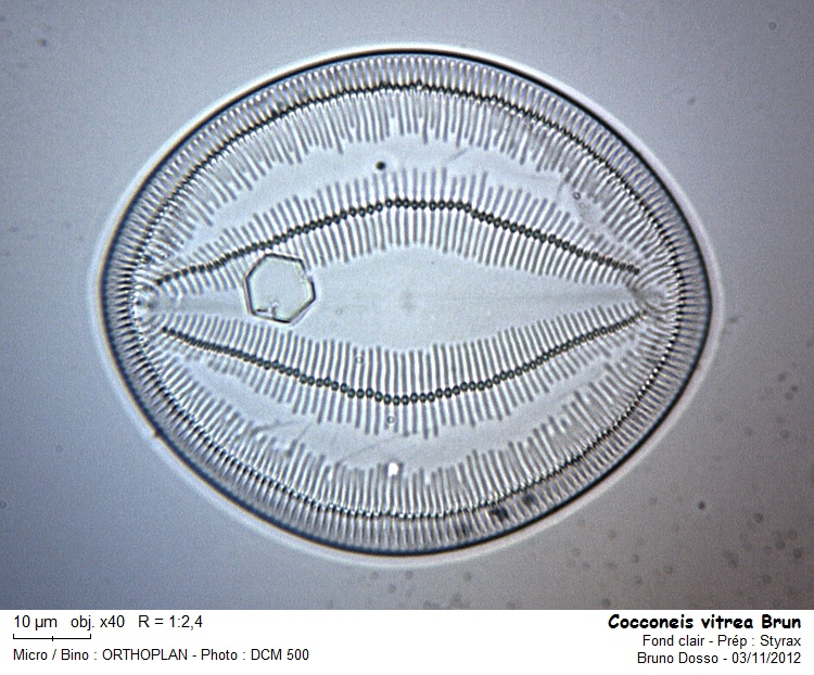 COCCONEIS vitrea Brun #28909