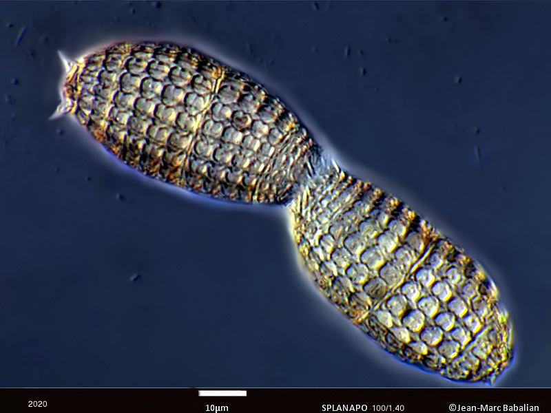 Coleps hirtus #62406