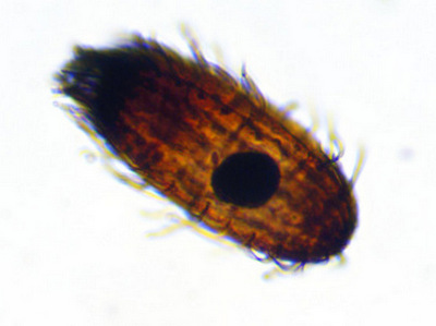 Coleps striatus #36258