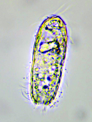 Coleps striatus #36254