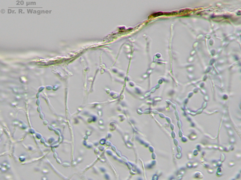 Collema cf. tenax #11443