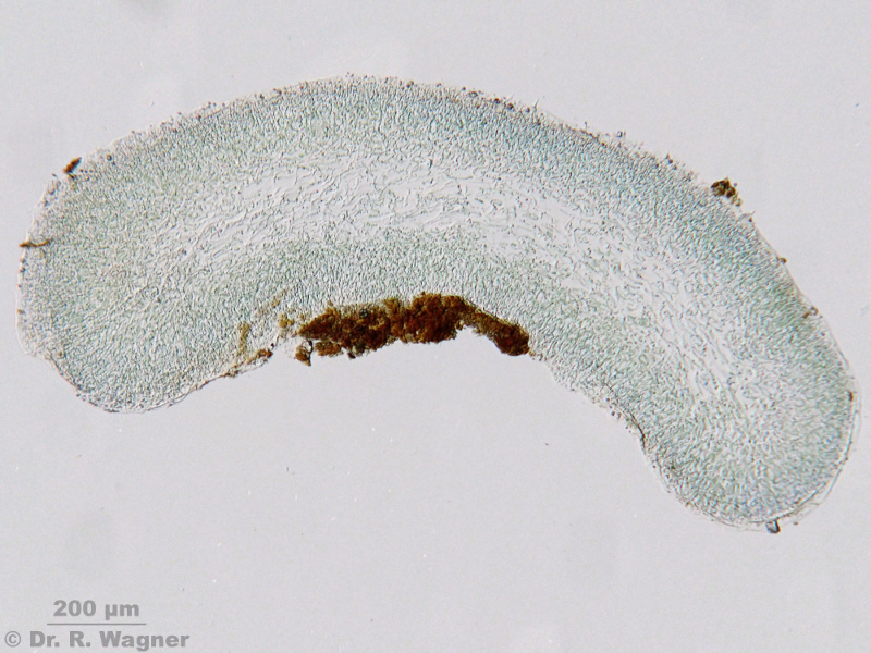 Collema cf. tenax #11441