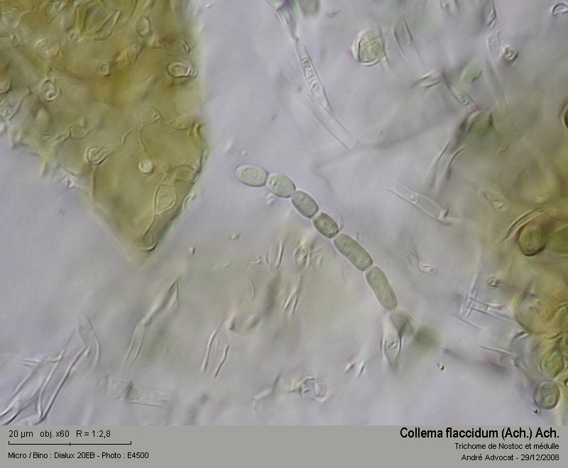 Collema flaccidum (Ach.) Ach. #34471