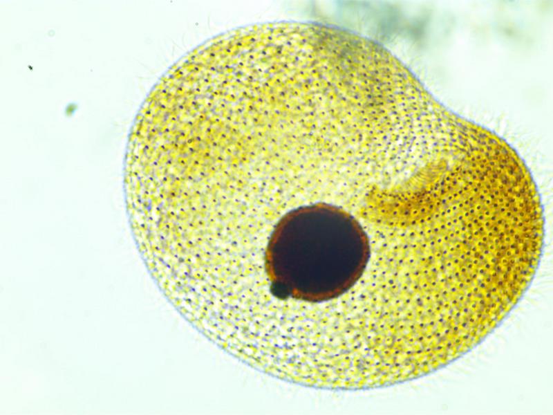 Colpoda sp. #35029
