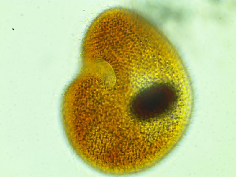 Colpoda sp. #35032