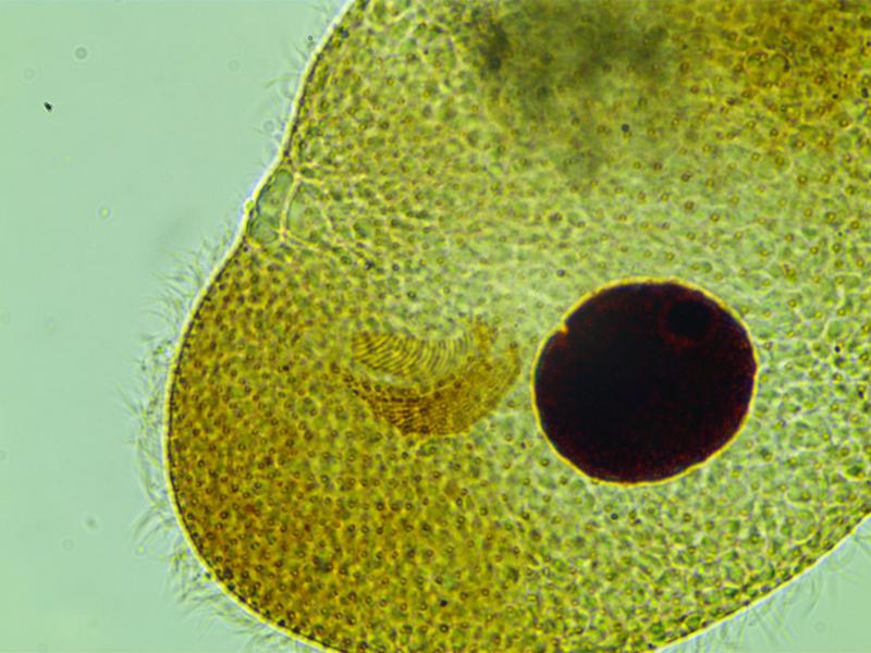 Colpoda sp. #35030