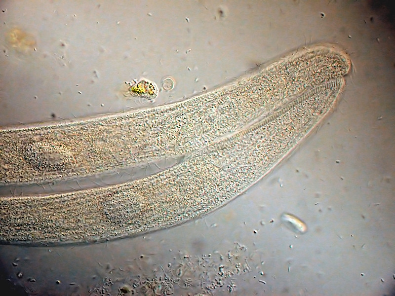 Conjugaison de Spirostomum #25617