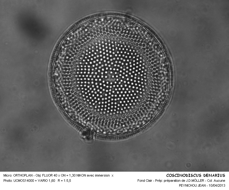 Coscinodiscus Denarius #30548