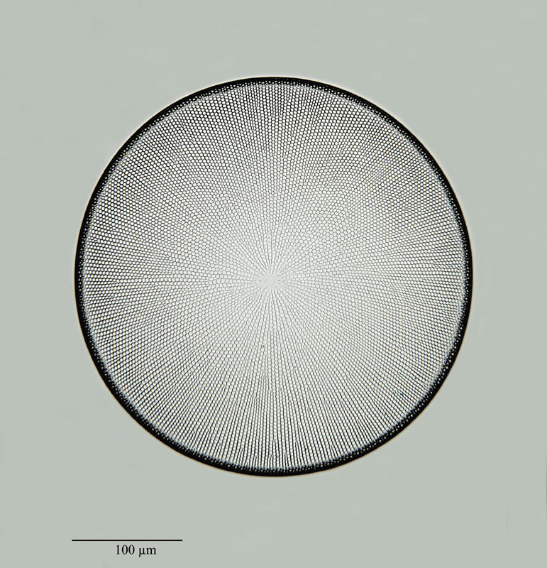 Coscinodiscus gigas Ehrenberg #22868