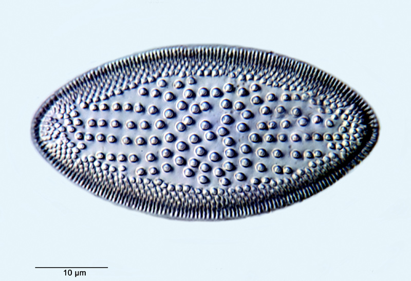 Coscinodiscus lewisianus Greville, 1866 #33331