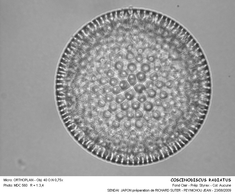 Coscinodiscus marginatus #12201