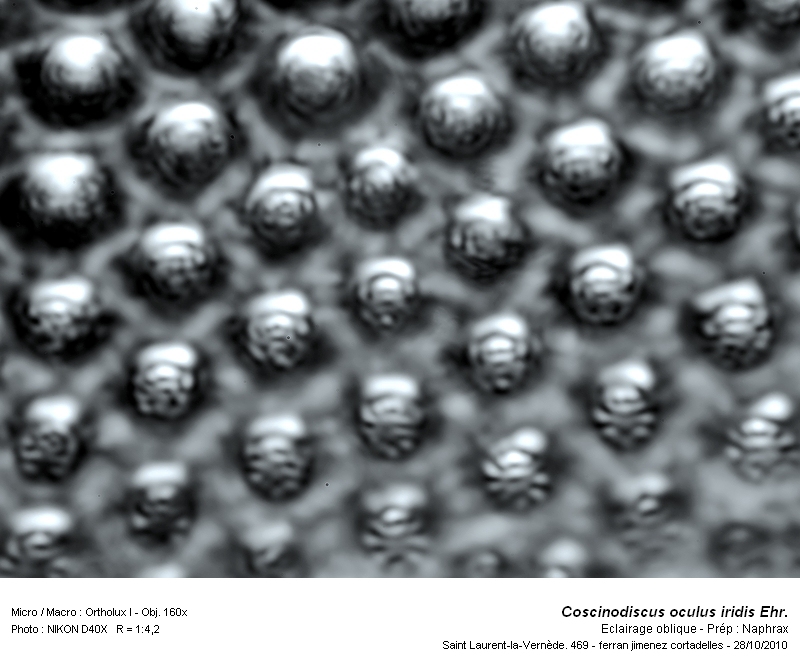 Coscinodiscus oculus iridis Ehr. #18809