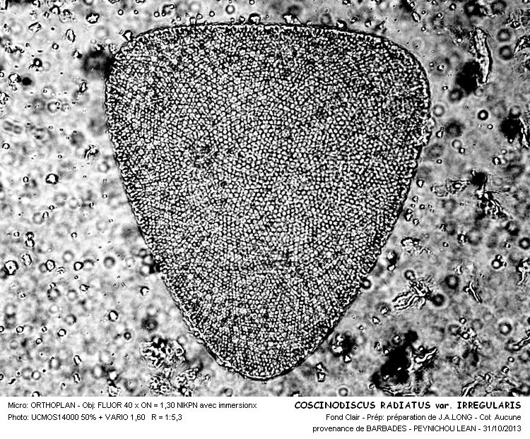 COSCINODISCUS RADIATUS var.IRREGULARIS #34562
