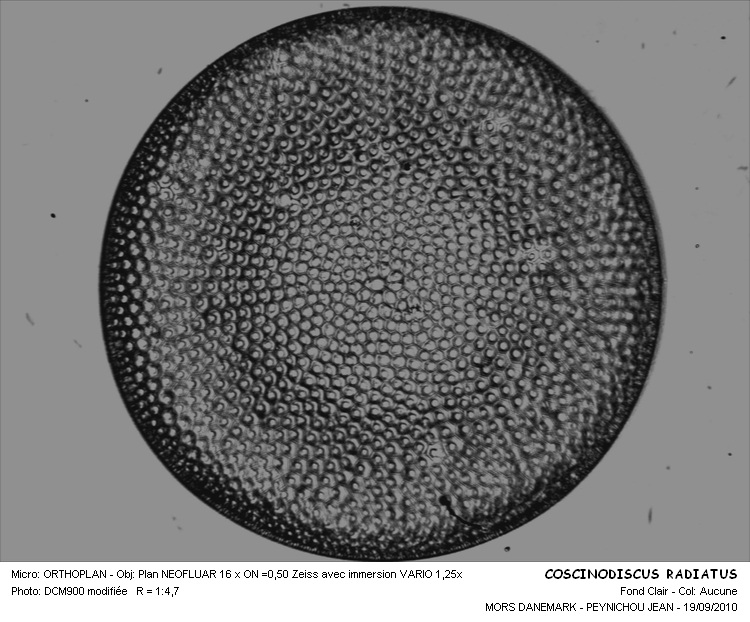 Coscinodiscus radiatus Ehrenberg #18143