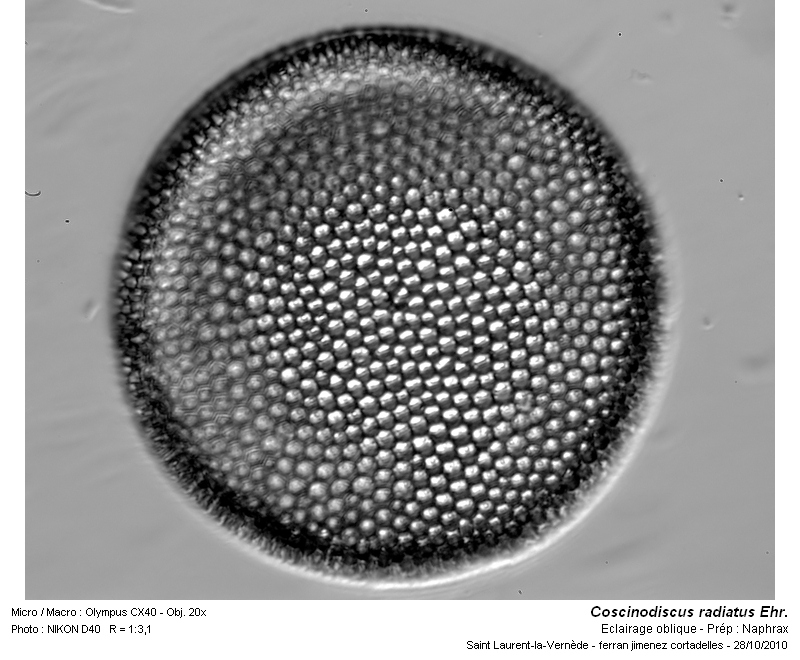 Coscinodiscus radiatus Ehr. #18753