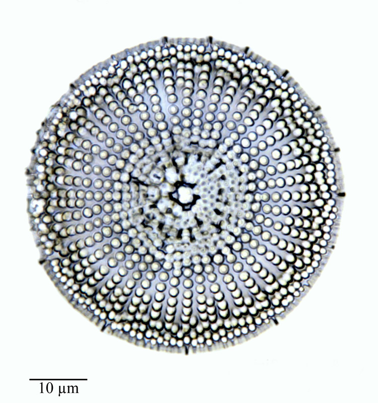 Coscinodiscus spiniferus #64308