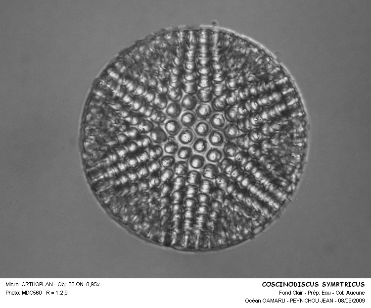 Coscinodiscus symetricus Greville #12351