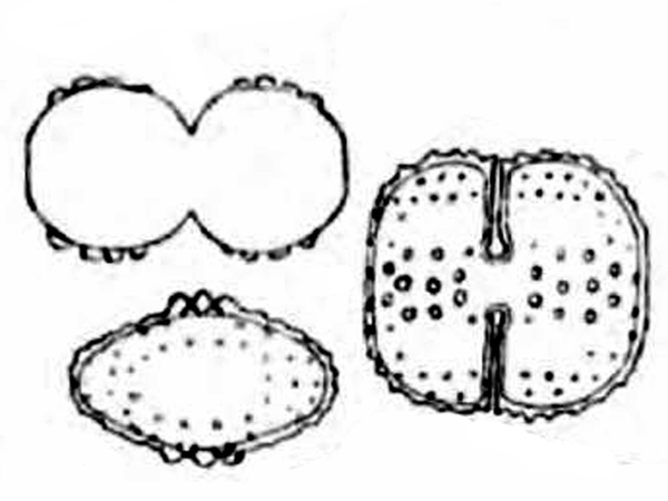 Cosmarium anisochondrum Nordstedt #76201