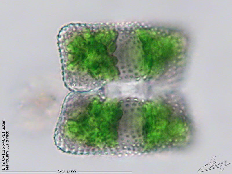 Cosmarium biretum #68395