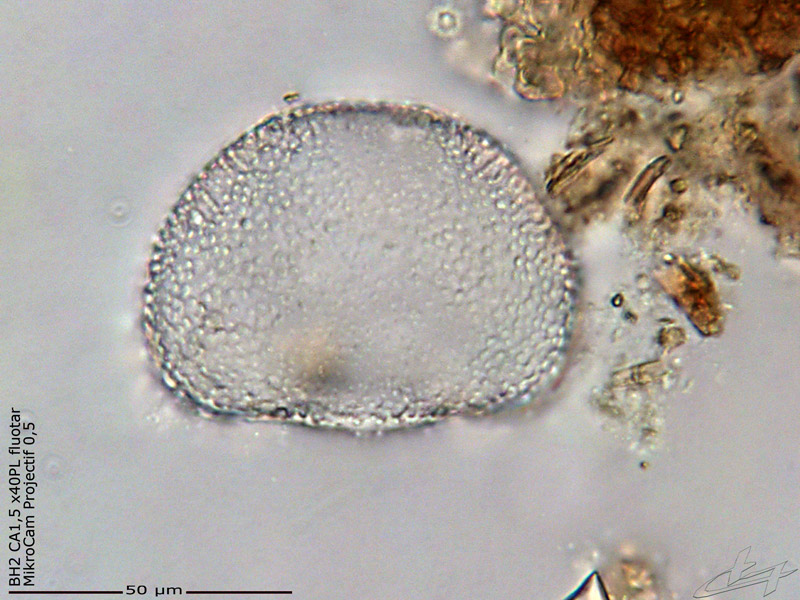 Cosmarium botrytis var botrytis #70922