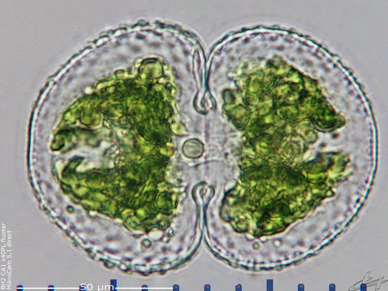 Cosmarium botrytis var botrytis #70918