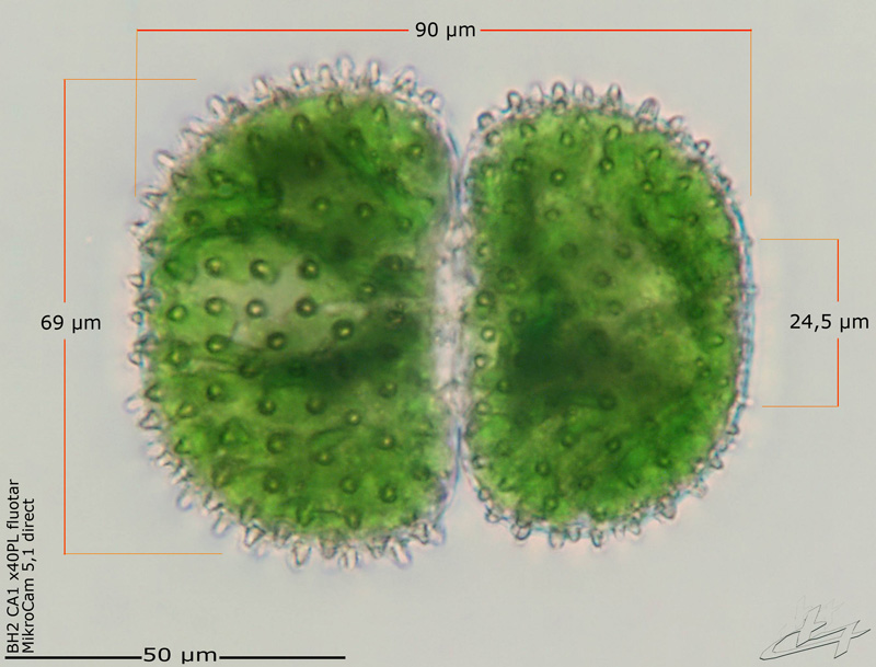 Cosmarium brebissonii Ralfs #66598