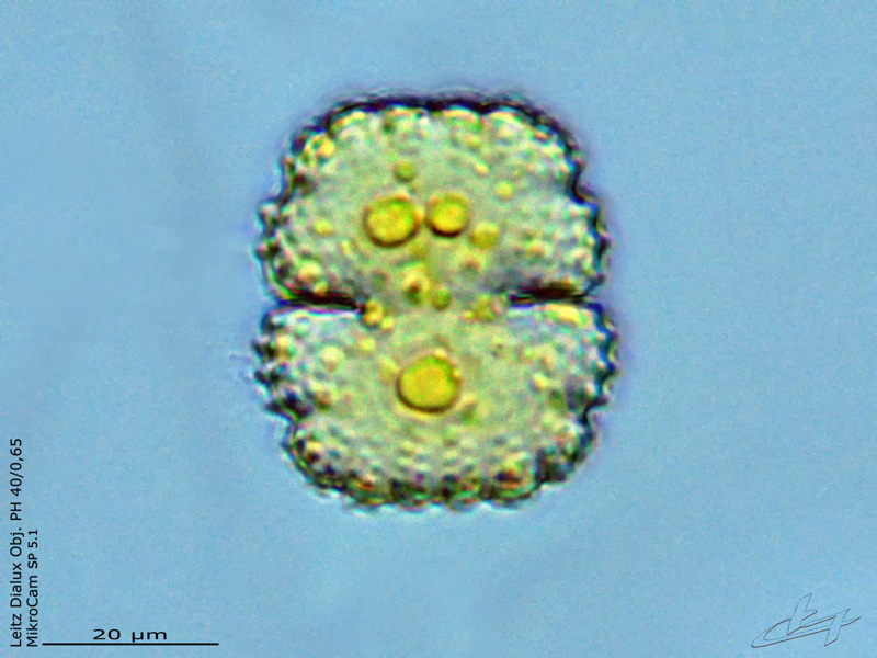 Cosmarium caelatum #63846