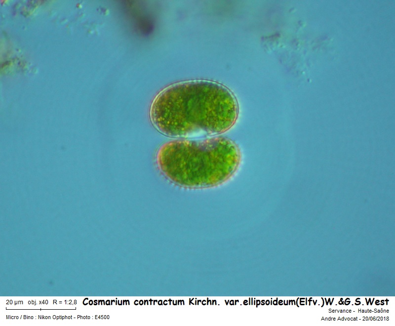 Cosmarium contractum Kirchn. var.ellipsoideum(Elfv.)W.&G.S.W #65342
