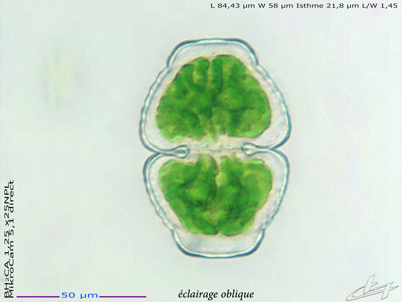 Cosmarium cymatopleurum Nordstedt 1872 #77434