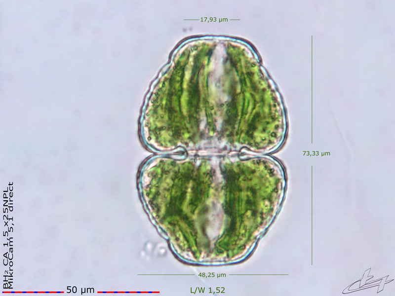 Cosmarium cymatopleurum Nordstedt 1872 #77433