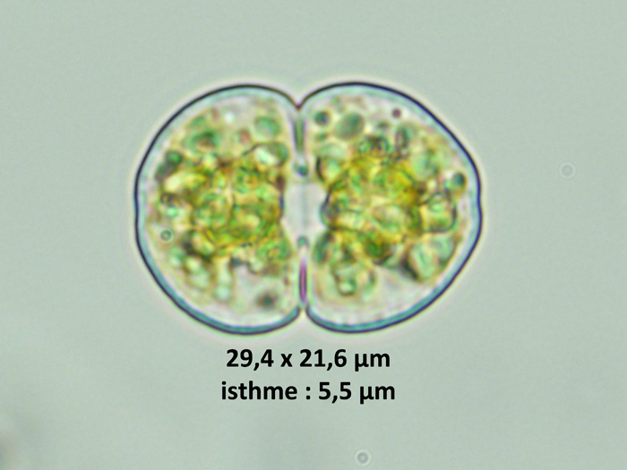 Cosmarium distentum #74728