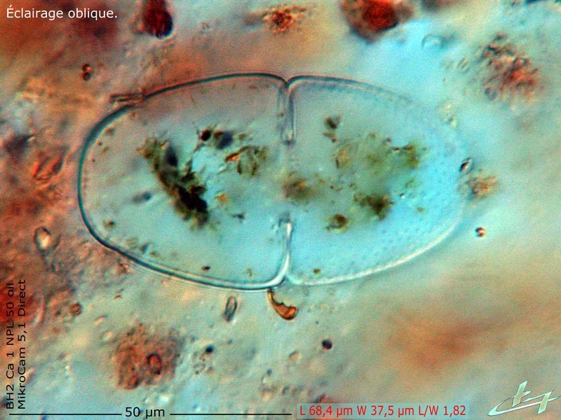 Cosmarium extensum #84536