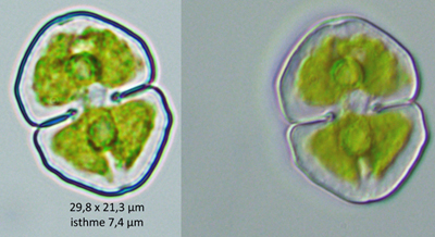 Cosmarium granatum Ralfs #74515