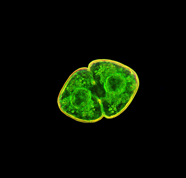 Cosmarium granatum #57511