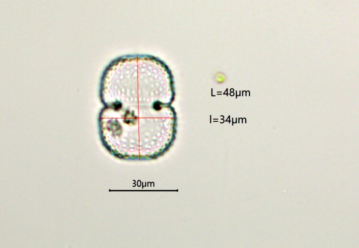 Cosmarium lenzenwegeri Stastny & Kouwets 2012 #78335