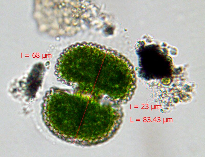 Cosmarium margaritatum #73250