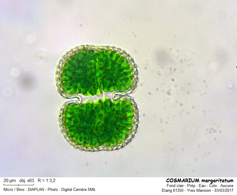 Cosmarium margaritatum #73249