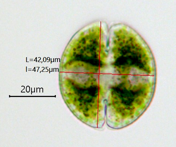 Cosmarium obsoletum #75752