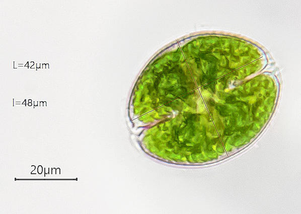 Cosmarium obsoletum #76611