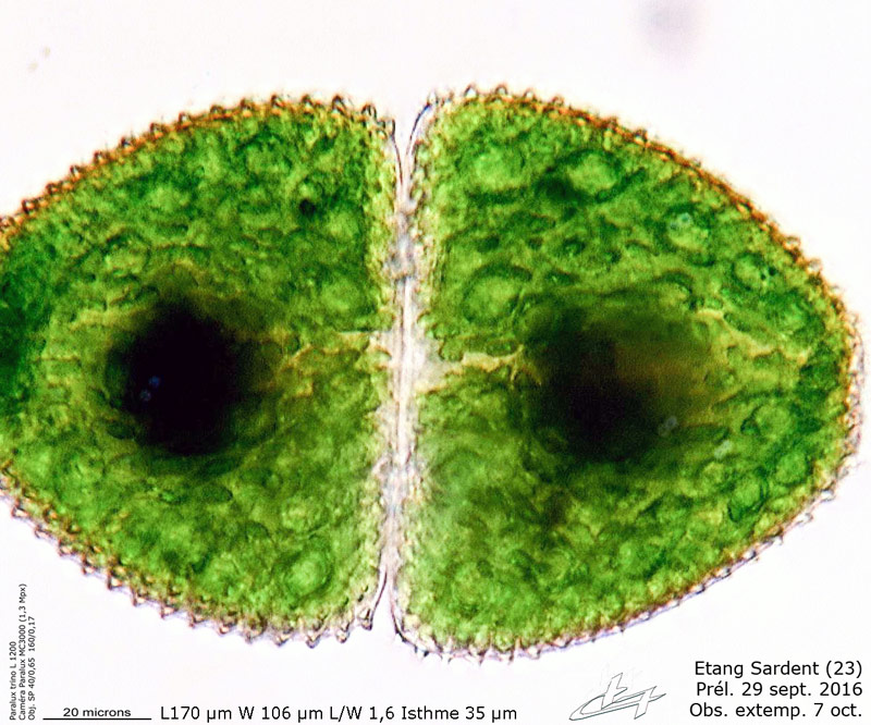 Cosmarium ovale #65149