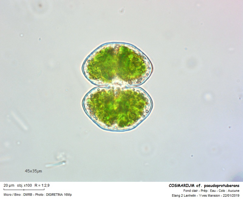 COSMARIUM pseudoprotuberans Kirchn. var. pseudoprotuberan #57354