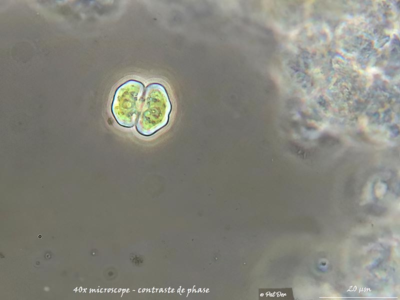 Cosmarium pseudowembaerense #76082