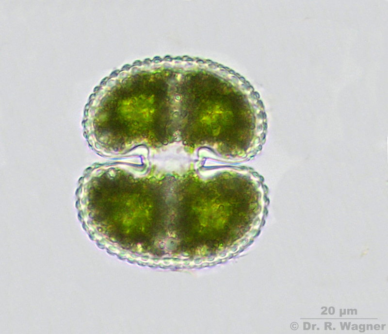 Cosmarium reniforme #8160