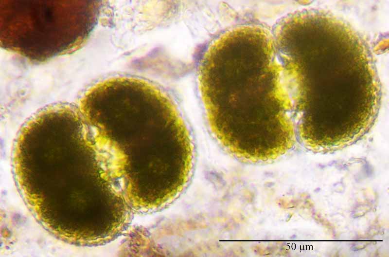 Cosmarium reniforme #51363