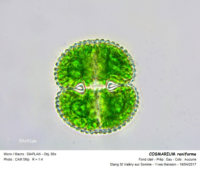 Cosmarium reniforme ( Ralfs) W.Archer #64596