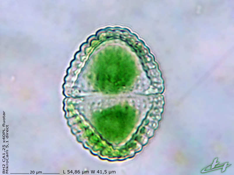 Cosmarium speciosum P. Lundell 1871 #77557