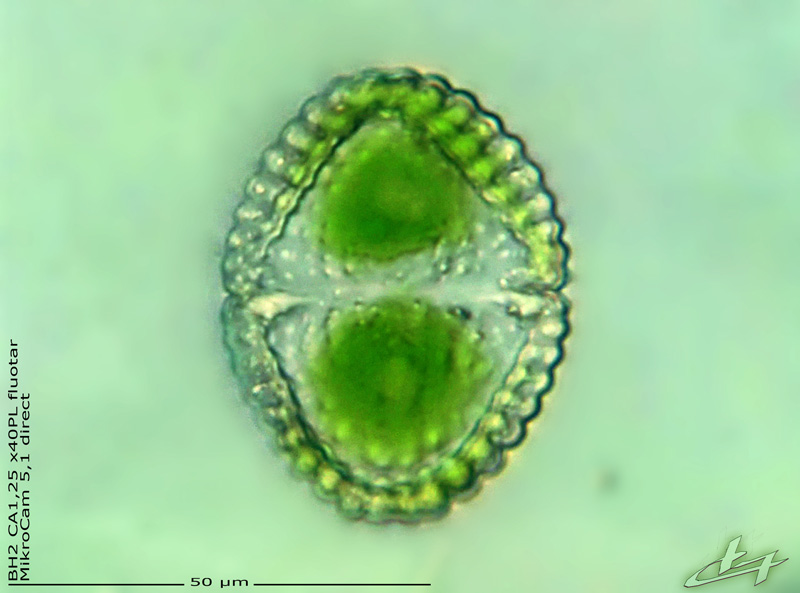 Cosmarium speciosum P. Lundell 1871 #77556