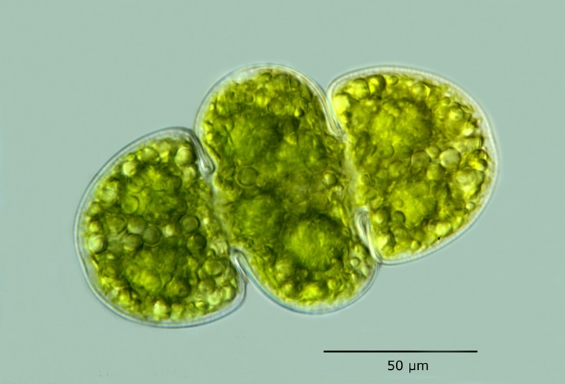 Cosmarium subcucumis - une difformité #17732